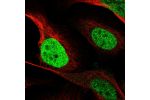 Immunofluorescent staining of human cell line U-2 OS shows localization to nucleoplasm.