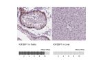 Immunohistochemistry analysis in human testis and liver tissues using HPA062273 antibody. Corresponding IGF2BP1 RNA-seq data are presented for the same tissues.