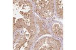 Immunohistochemical staining of human testis shows moderate cytoplasmic and nuclear positivity in cells in seminiferous ducts and Leydig cells.