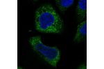 Immunofluorescent staining of human cell line U-2 OS shows localization to endoplasmic reticulum.