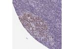 Immunohistochemical staining of human lymph node shows moderate to strong nuclear positivity in germinal center cells.