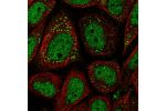 Immunofluorescent staining of human cell line SiHa shows localization to nucleoplasm & lipid droplets.
