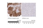 Immunohistochemistry analysis in human skeletal muscle and liver tissues using HPA062605 antibody. Corresponding ATP2A2 RNA-seq data are presented for the same tissues.
