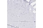 Immunohistochemical staining of human skeletal muscle shows no positivity in myocytes as expected.