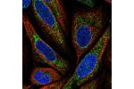 Immunofluorescent staining of human cell line SiHa shows localization to mitochondria.