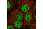 Immunofluorescent staining of human cell line A-431 shows localization to nucleoplasm.