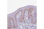 Immunohistochemical staining of human skin shows moderate cytoplasmic positivity in keratinocytes.