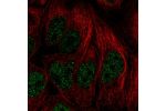 Immunofluorescent staining of human cell line CACO-2 shows localization to nucleus.