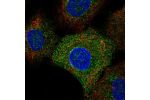 Immunofluorescent staining of human cell line A549 shows localization to endoplasmic reticulum.