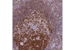 Immunohistochemical staining of human lymph node shows strong cytoplasmic and nuclear positivity in germinal center cells.