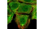 Immunofluorescent staining of human cell line MCF7 shows localization to nucleoplasm & cytosol.
