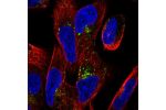 Immunofluorescent staining of human cell line RH-30 shows localization to the Golgi apparatus & vesicles.