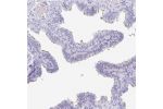 Immunohistochemical staining of human fallopian tube shows moderate positivity in cilia in glandular cells.