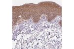 Immunohistochemical staining of human skin shows strong cytoplasmic positivity in epidermal cells.