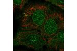 Immunofluorescent staining of human cell line HaCaT shows localization to nuclear membrane & cytosol.