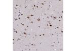 Immunohistochemical staining of human cerebral cortex shows strong nuclear positivity in neuronal and glial cells.