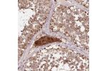 Immunohistochemical staining of human testis shows moderate cytoplasmic positivity in cells in seminiferous ducts, Leydig cells were strongly stained.