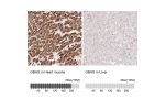 Immunohistochemistry analysis in human heart muscle and liver tissues using HPA063084 antibody. Corresponding GBAS RNA-seq data are presented for the same tissues.