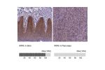 Immunohistochemistry analysis in human skin and pancreas tissues using HPA063121 antibody. Corresponding IRF6 RNA-seq data are presented for the same tissues.