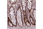 Immunohistochemical staining of human colon shows strong nuclear positivity in glandular cells.