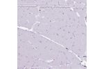 Immunohistochemical staining of human skeletal muscle shows no positivity in myocytes as expected.