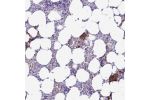 Immunohistochemical staining of human bone marrow shows strong cytoplasmic positivity in megakaryocytes.