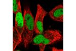 Immunofluorescent staining of human cell line RH-30 shows localization to nucleoplasm.