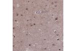 Immunohistochemical staining of human cerebral cortex shows strong nuclear positivity in neurons.