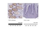 Immunohistochemistry analysis in human rectum and liver tissues using Anti-ITLN1 antibody. Corresponding ITLN1 RNA-seq data are presented for the same tissues.