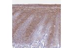 Immunohistochemical staining of human skin shows moderate cytoplasmic positivity in squamous epithelial cells.