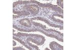 Immunohistochemical staining of human skin shows strong cytoplasmic positivity in epidermal cells.