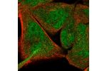 Immunofluorescent staining of human cell line RH-30 shows localization to nucleus & cytosol.