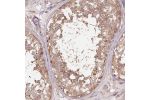 Immunohistochemical staining of human testis shows moderate cytoplasmic positivity in cells in seminiferous ducts.