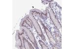 Immunohistochemical staining of human stomach shows moderate nuclear positivity in glandular cells.