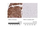 Immunohistochemistry analysis in human pancreas and cerebral cortex tissues using HPA063471 antibody. Corresponding PRSS1 RNA-seq data are presented for the same tissues.