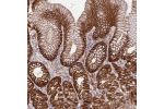 Immunohistochemical staining of human stomach shows membranous and cytoplasmic positivity in glandular cells.