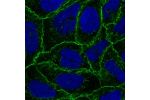 Immunofluorescent staining of human cell line CACO-2 shows localization to plasma membrane & cell junctions.