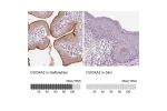 Immunohistochemistry analysis in human gallbladder and skin tissues using HPA063548 antibody. Corresponding DUOXA2 RNA-seq data are presented for the same tissues.