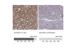 Immunohistochemistry analysis in human liver and pancreas tissues using Anti-SULT2A1 antibody. Corresponding SULT2A1 RNA-seq data are presented for the same tissues.
