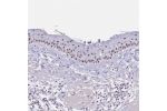 Immunohistochemical staining of human skin shows strong positivity in nucleoli in squamous epithelial cells.