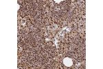 Immunohistochemical staining of human lymph node shows very strong nuclear positivity in non-germinal center cells.