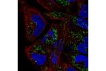 Immunofluorescent staining of human cell line RH-30 shows localization to mitochondria.
