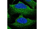 Immunofluorescent staining of human cell line U-2 OS shows localization to plasma membrane & vesicles.