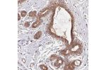 Immunohistochemical staining of human breast shows strong membranous and cytoplasmic positivity in glandular cells.