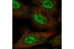 Immunofluorescent staining of human cell line A549 shows localization to nucleoplasm & cytosol.
