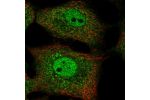 Immunofluorescent staining of human cell line A549 shows localization to nucleoplasm & cytosol.