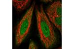 Immunofluorescent staining of human cell line SiHa shows localization to nucleus, nuclear bodies & cytosol.