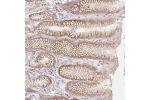 Immunohistochemical staining of human stomach shows moderate membranous positivity in glandular cells.