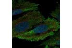 Immunofluorescent staining of human cell line SiHa shows localization to nucleoplasm & plasma membrane.