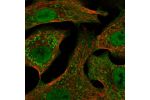 Immunofluorescent staining of human cell line A549 shows localization to nucleoplasm, plasma membrane & mitochondria.